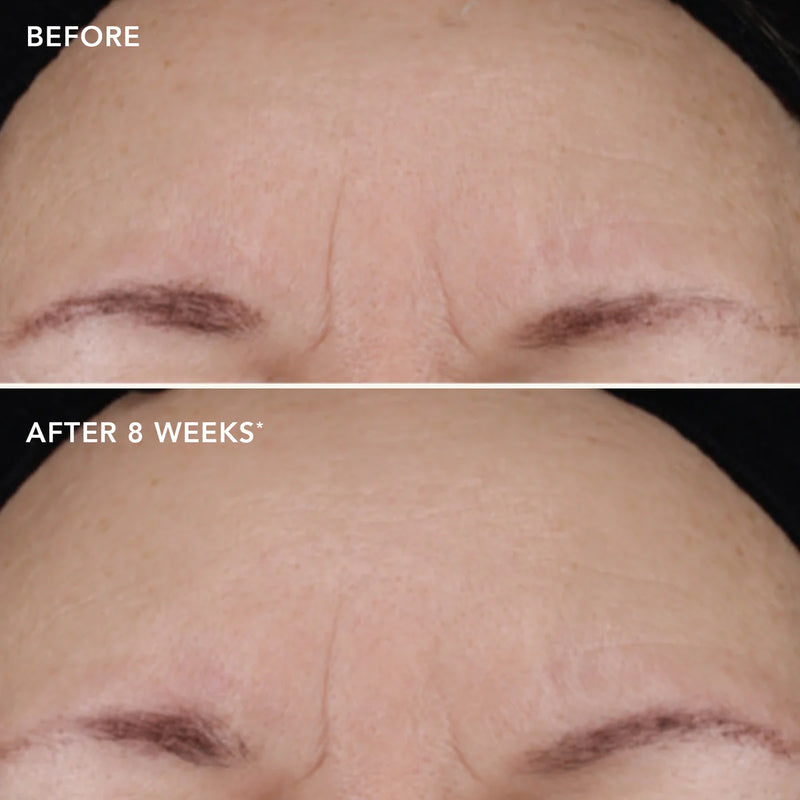 AGELESS+ Treatment Crème 1.2% Retinol Complex