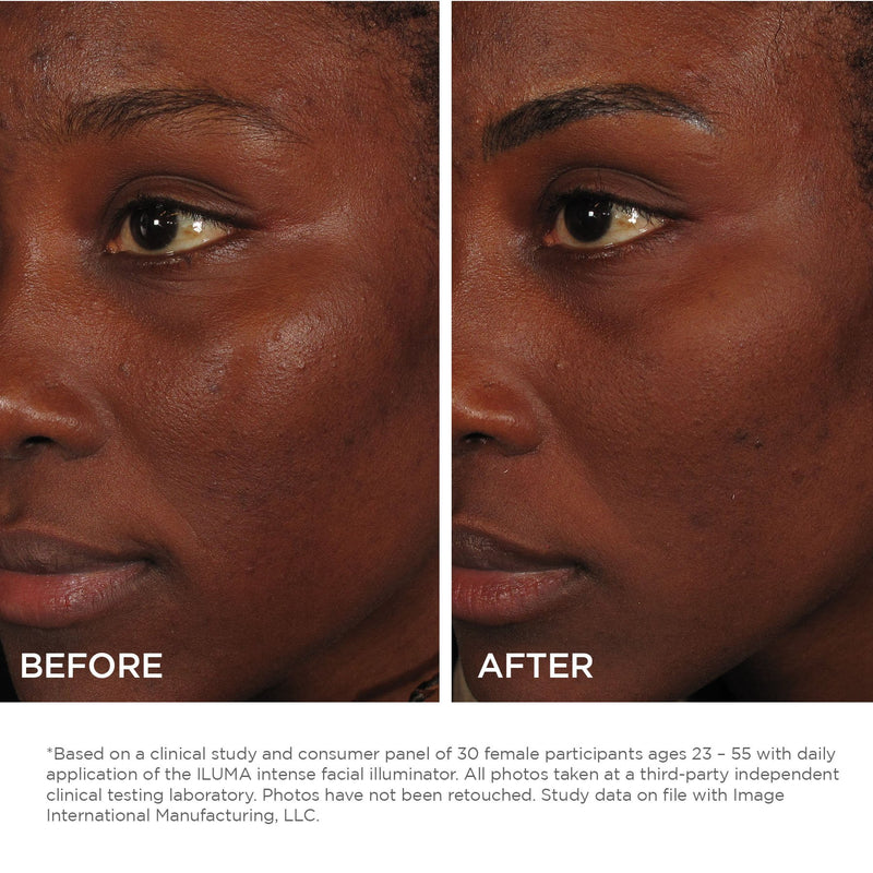 iluma intense facial illuminator - Image Skincare